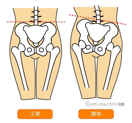 妊娠中の運動